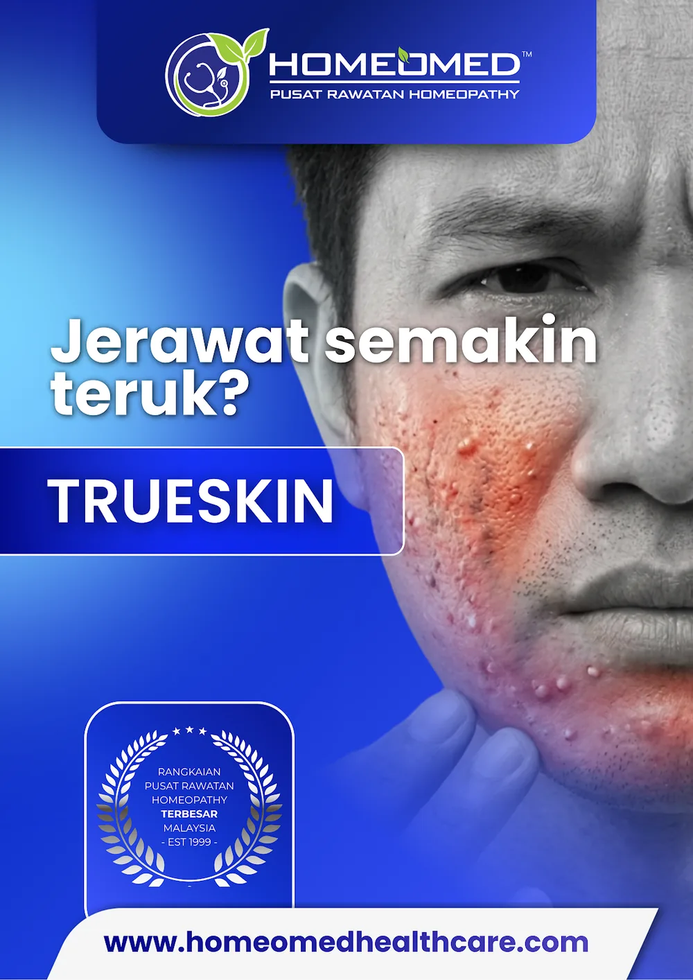 Jerawat & Kulit